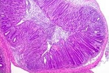 WEBINAR-IMAGE-epistem