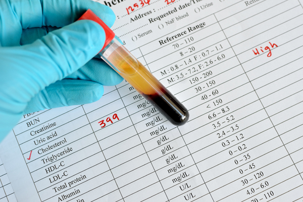 Statins, Diabetes