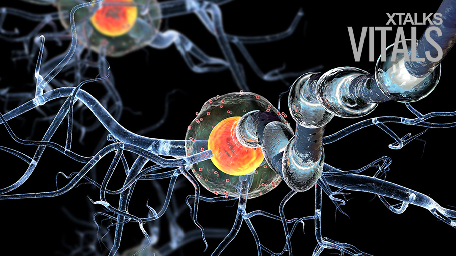Huntington's Disease