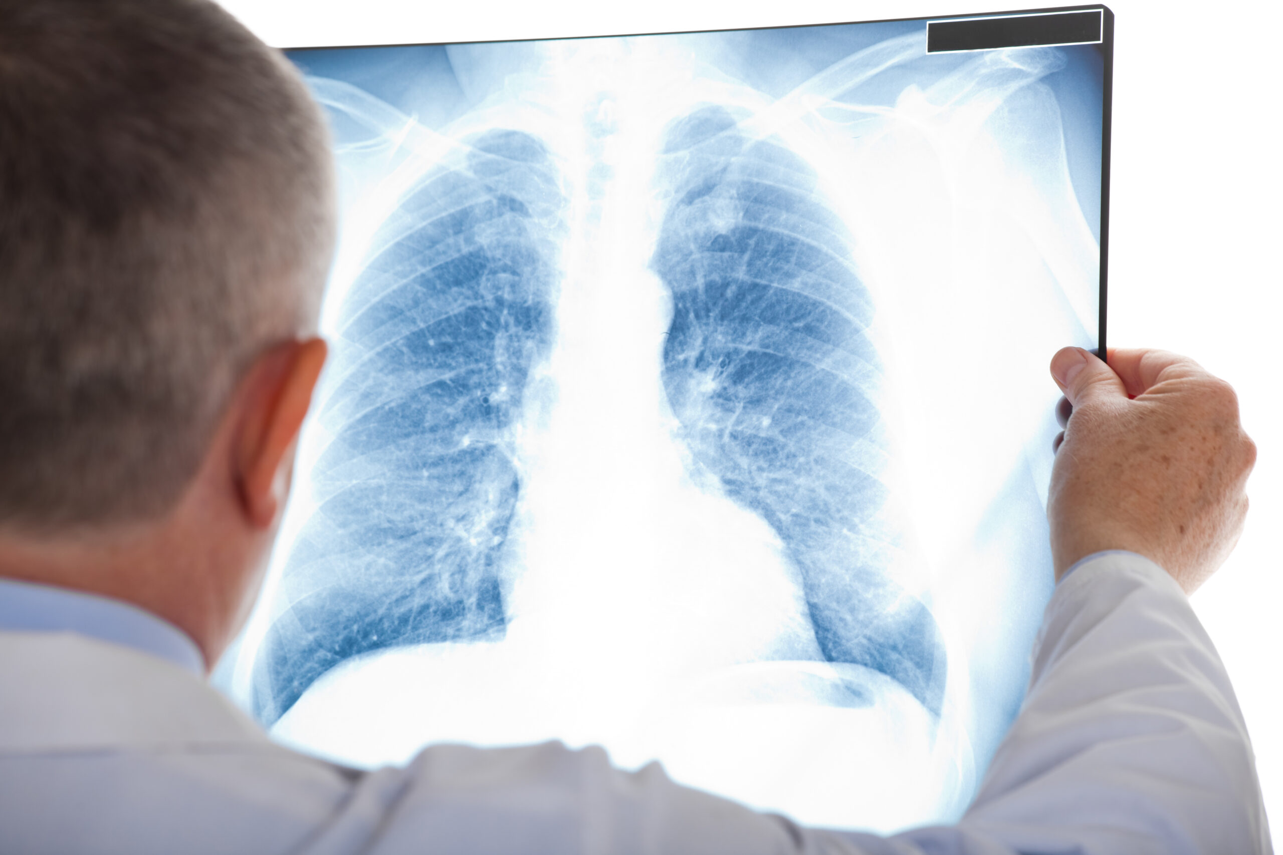Clinical Trial