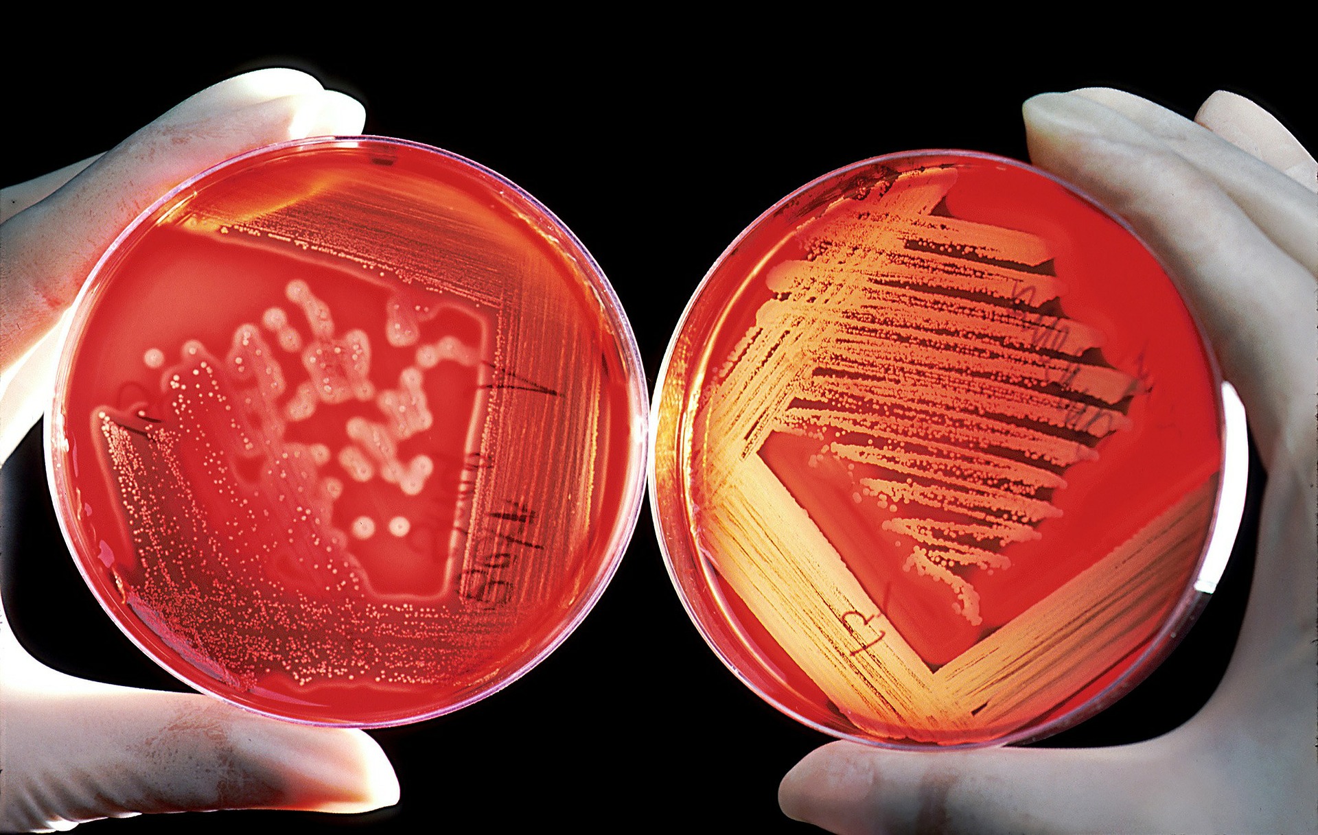 Bacteria growing in petri dish with agar