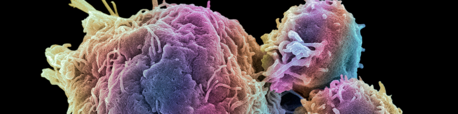 Immune-cell-stock-image-Nanostring