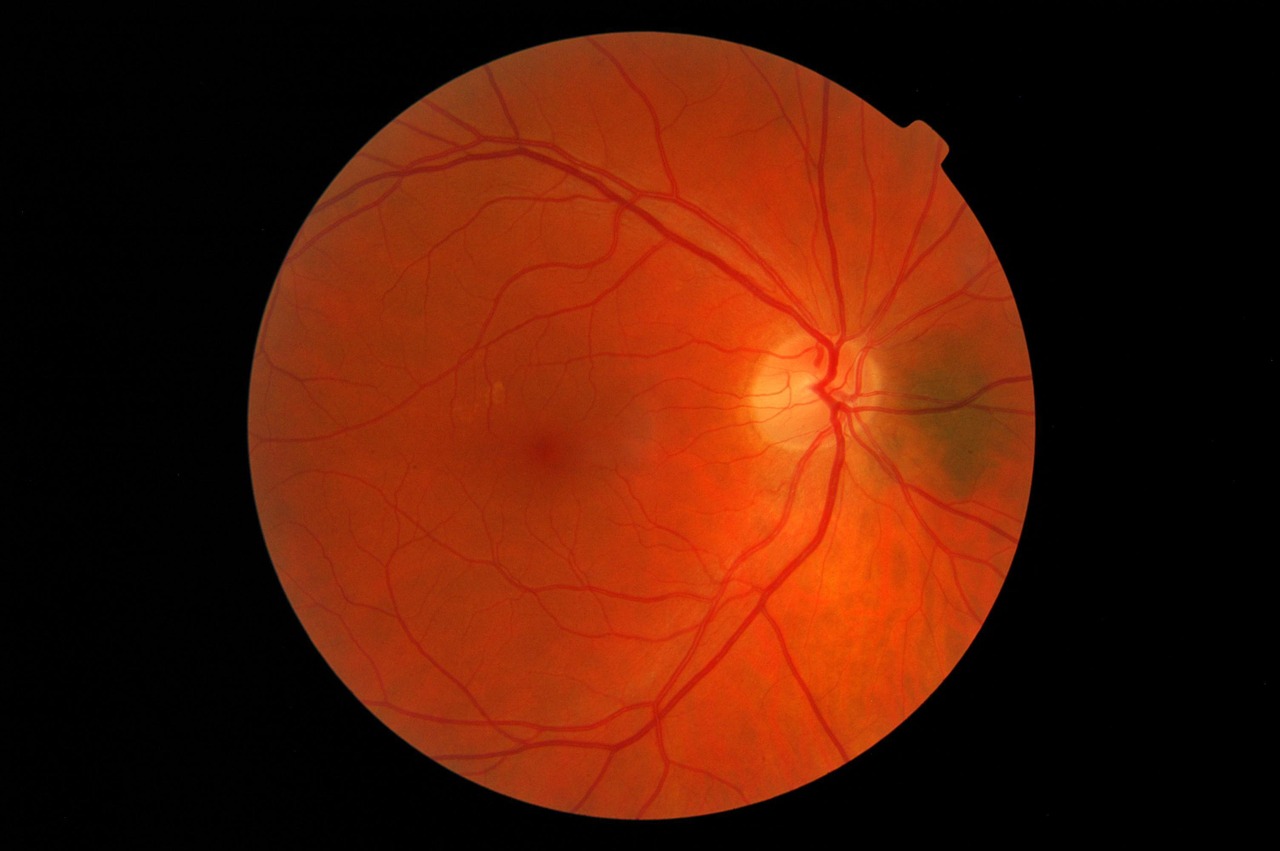 Retina of human eye
