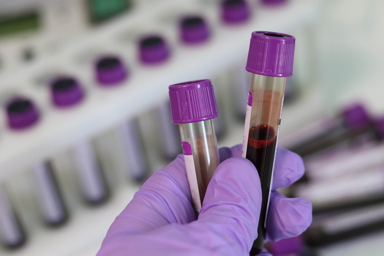 Blood samples held in gloved hand at a laboratory