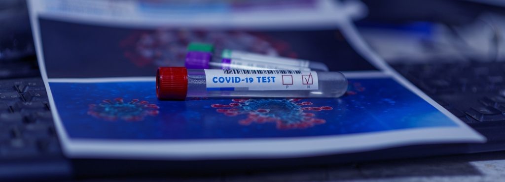 COVID-19 tests