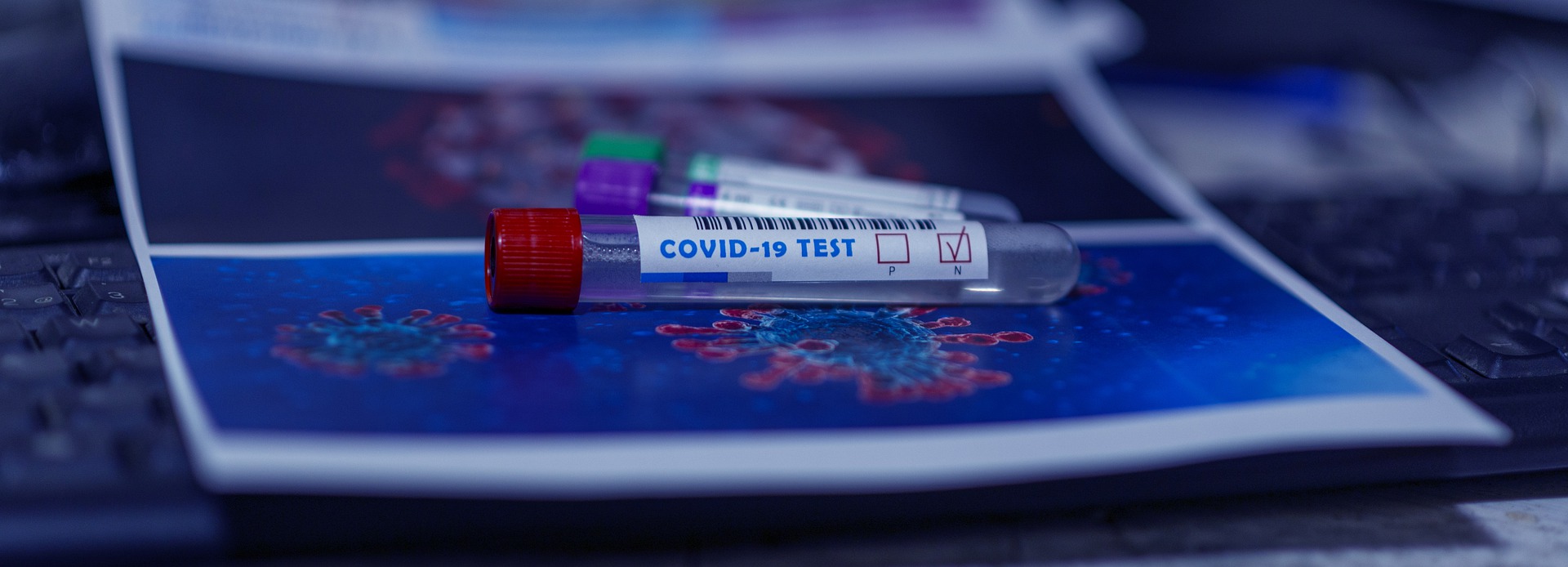 COVID-19 tests