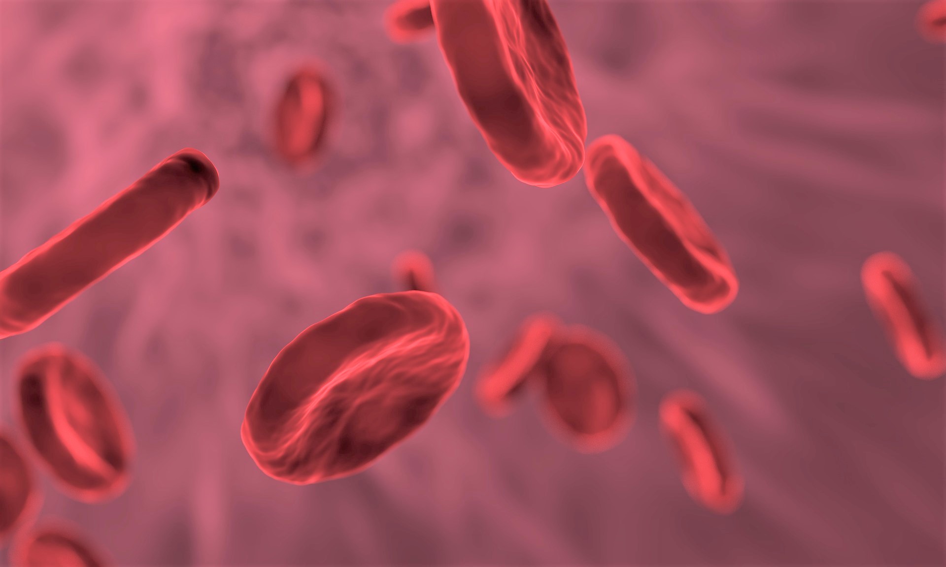 COVID-19 vaccine-induced blood clot screening