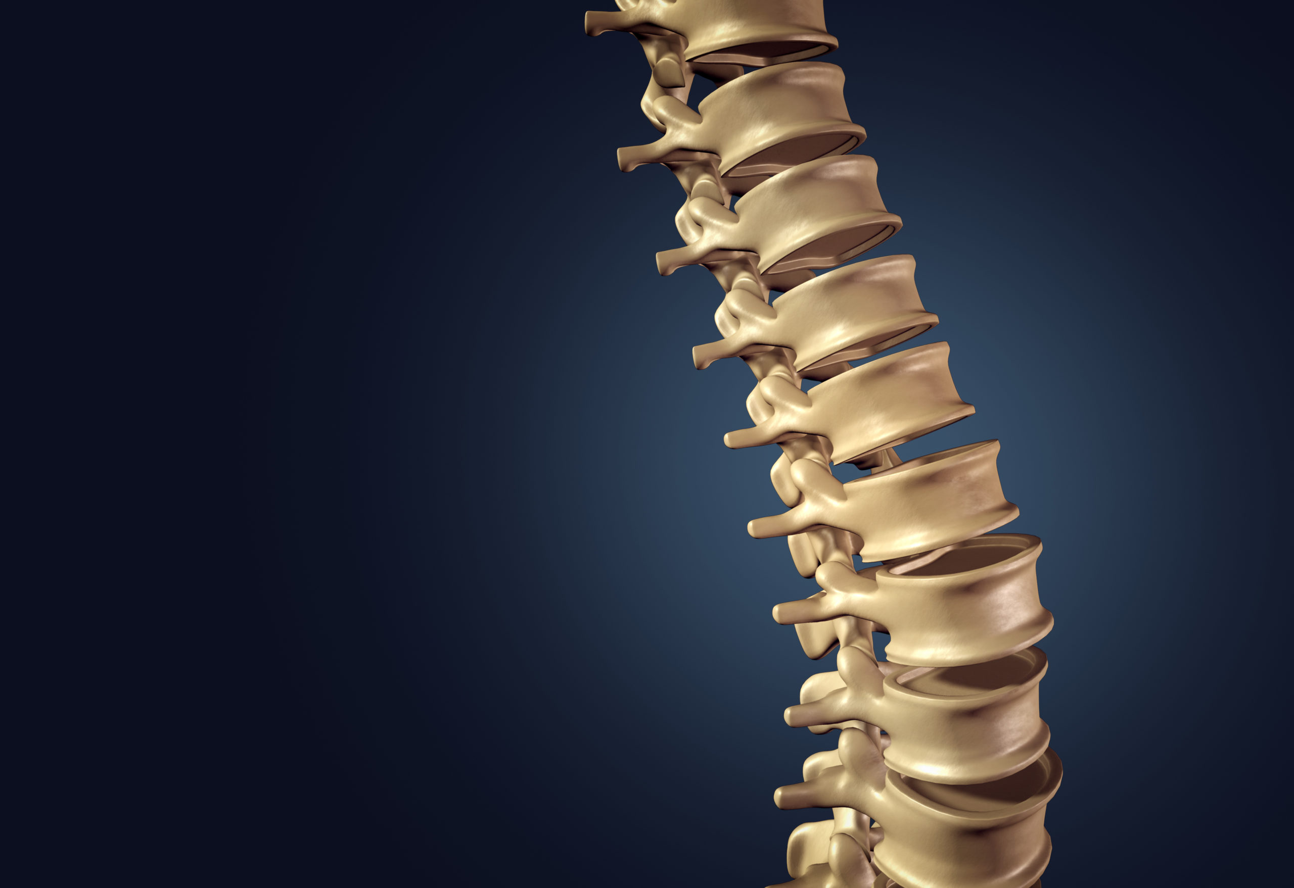 Spinal Implant