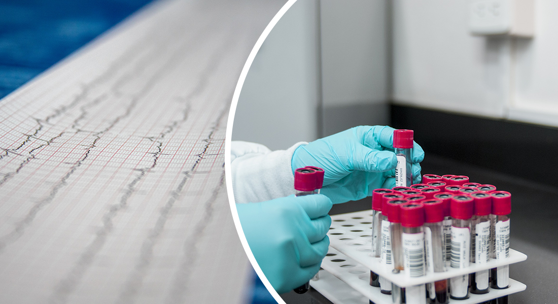 Life Science Podcast 60