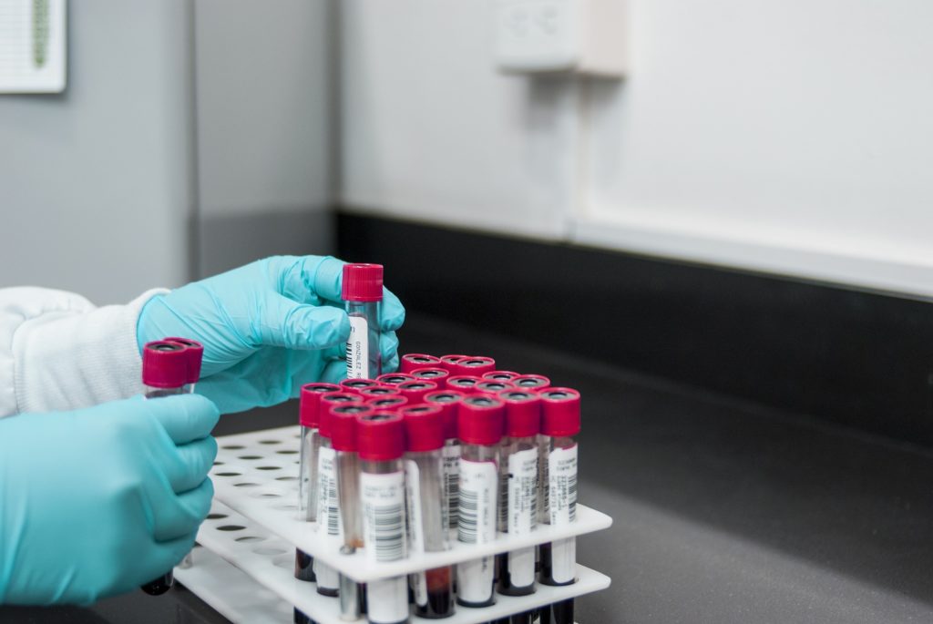 Ovarian Cancer Biomarker