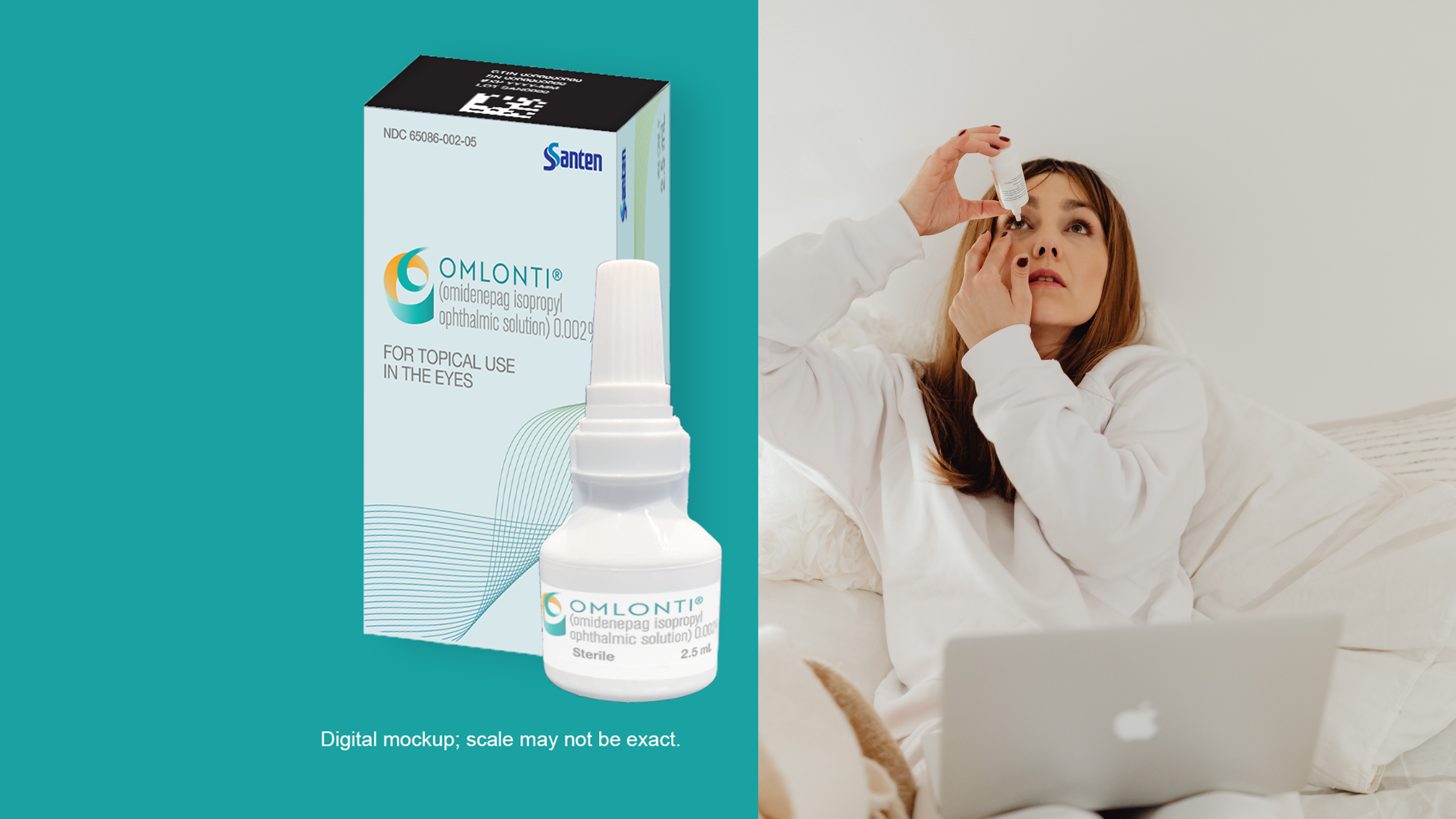 Omlonti eye drops for reducing elevated intraocular pressure (IOP) in patients with primary open-angle glaucoma or ocular hypertension.