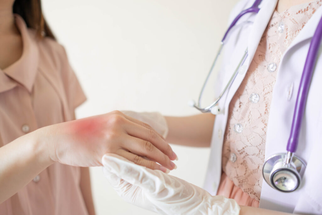 Lebrikizumab Could Soon Be a New Treatment for Atopic Dermatitis