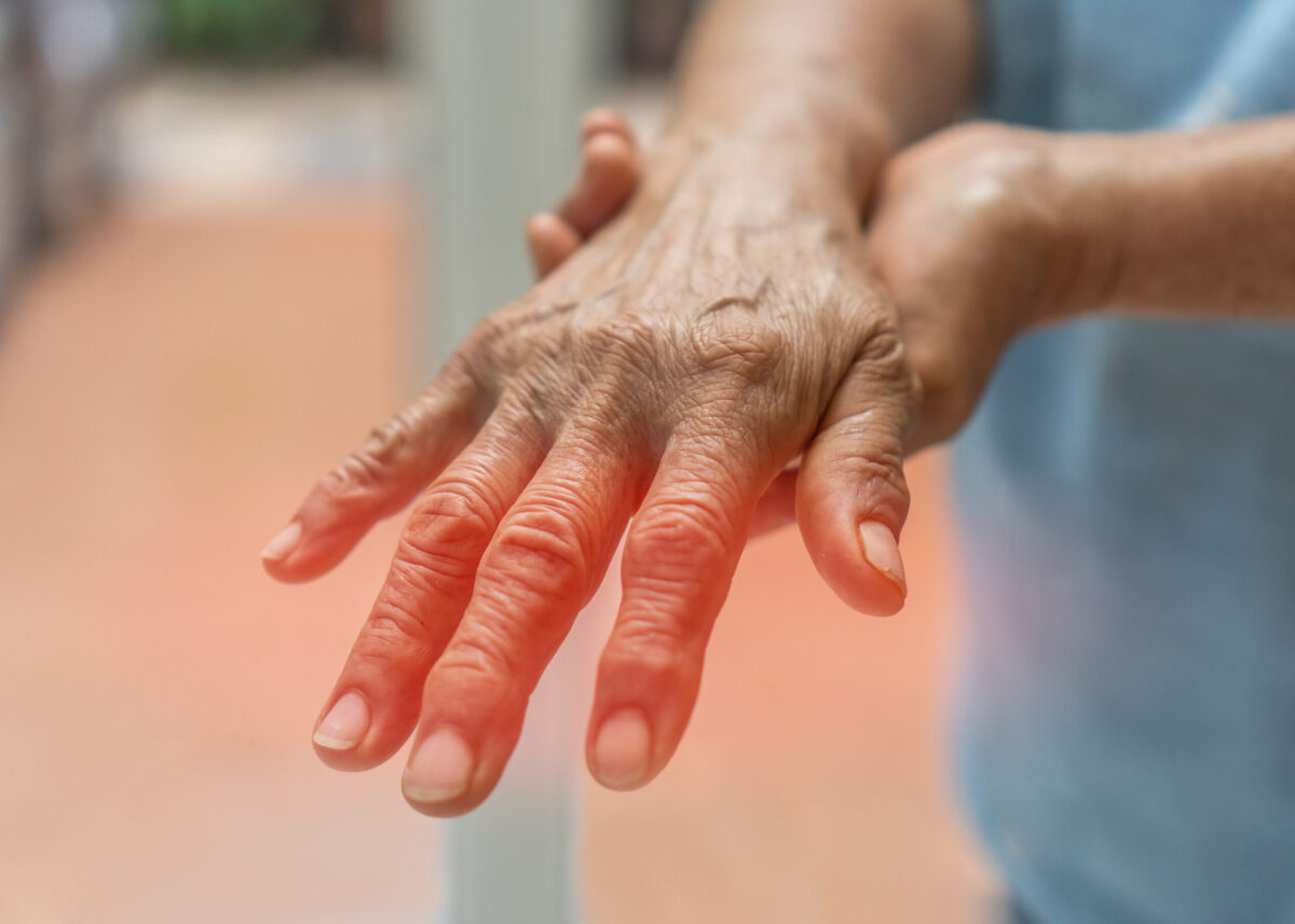 Vyvgart Hytrulo,CIDP, Chronic inflammatory demyelinating polyneuropathy, Neuromuscular Disorder