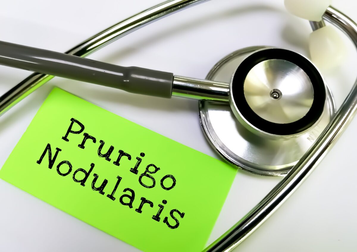 Nemolizumab, Nemluvio, Prurigo Nodularis, Skin Lesions