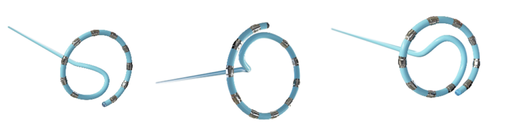 Variable catheter loops