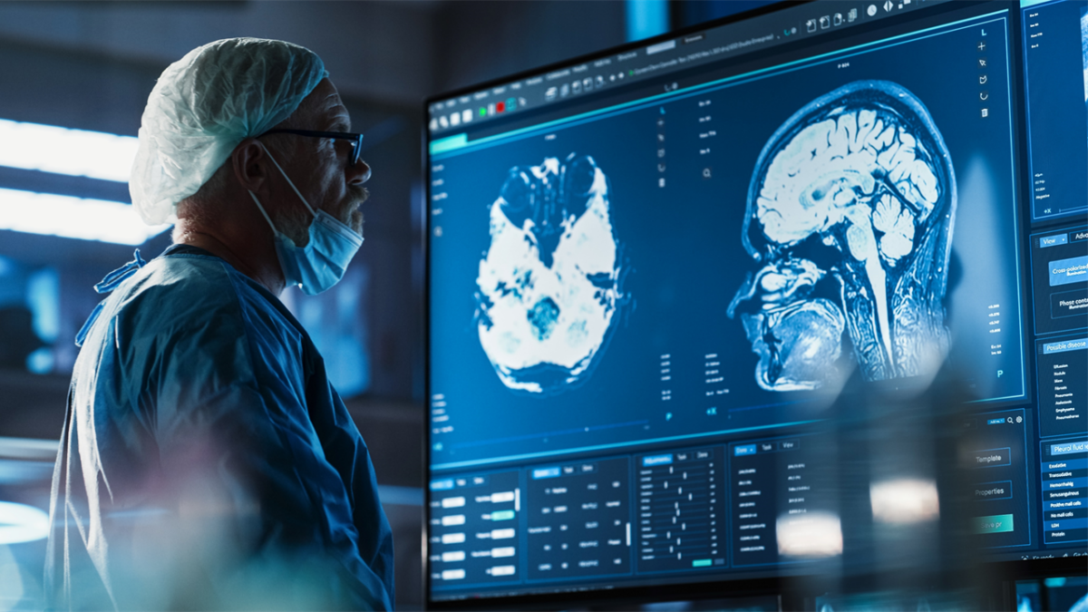 SIGNA MAGNUS 3.0T, Neuroimaging, MRI, magnetic resonance imaging, Brain Scan