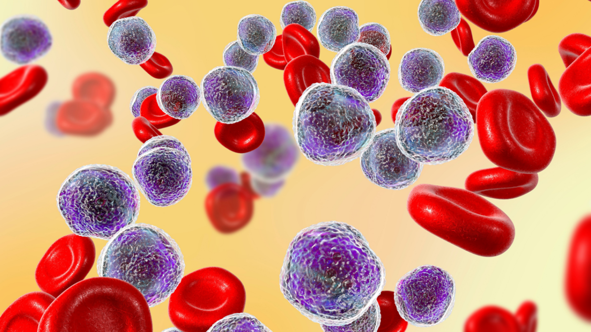 Ziftomenib, ziftomenib aml, AML, KOMET, Acute Myeloid Leukemia, Kura Oncology, Kyowa Kirin