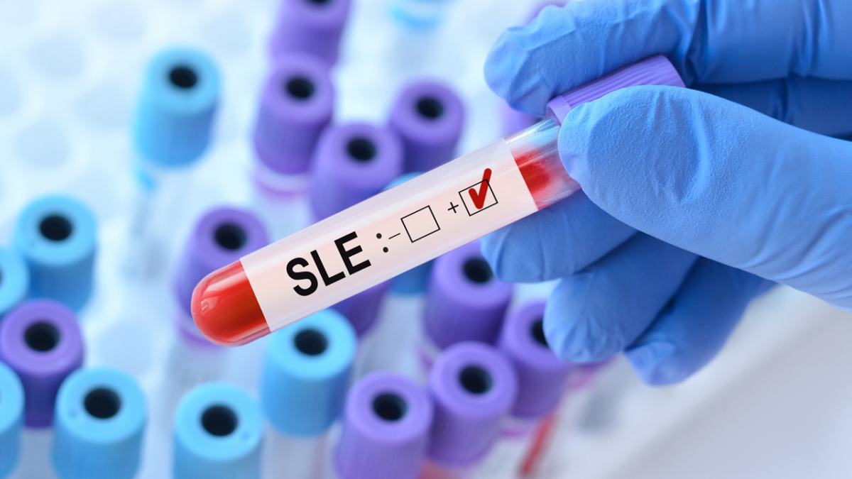 Cenerimod, cenerimod phase 3, Sle, sle lupus, systemic lupus erythematosus