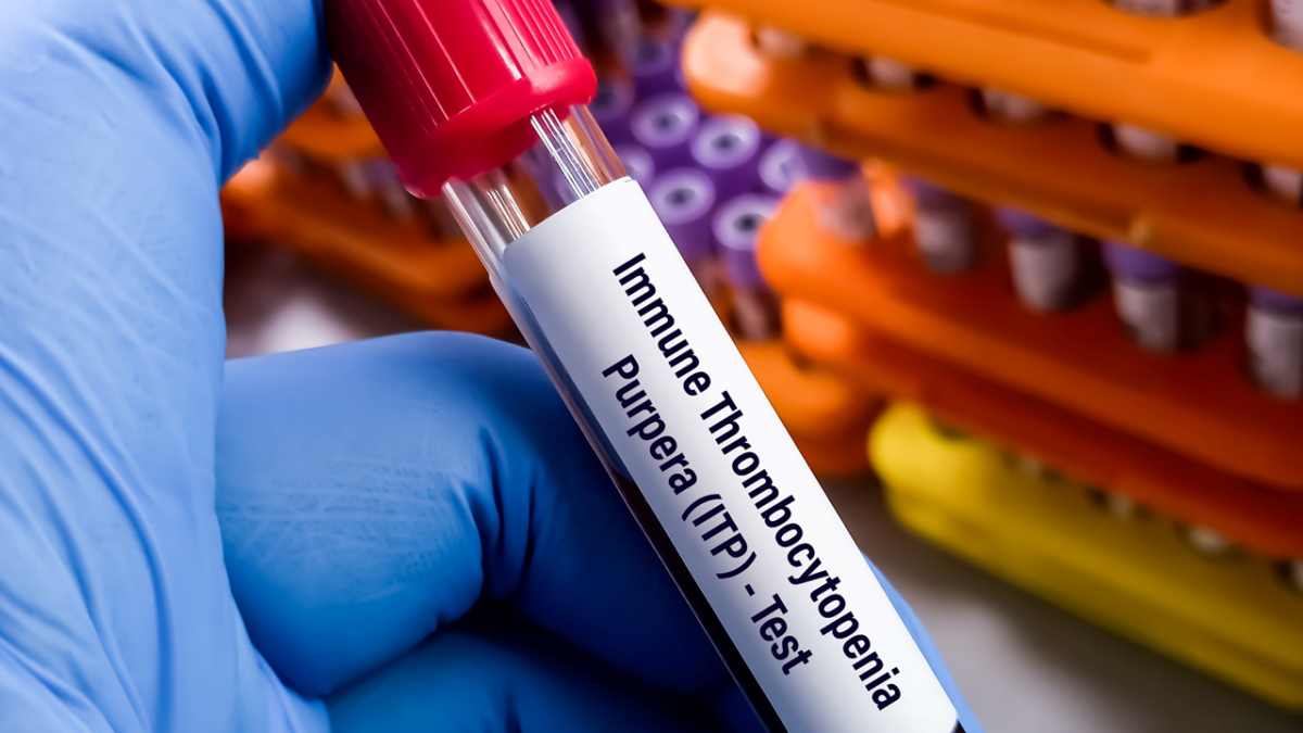 Rilzabrutinib, Luna 3, BTKi, rilzabrutinib itp, ITP, thrombocytopenia, immune thrombocytopenia, Bruton’s tyrosine kinase inhibitor