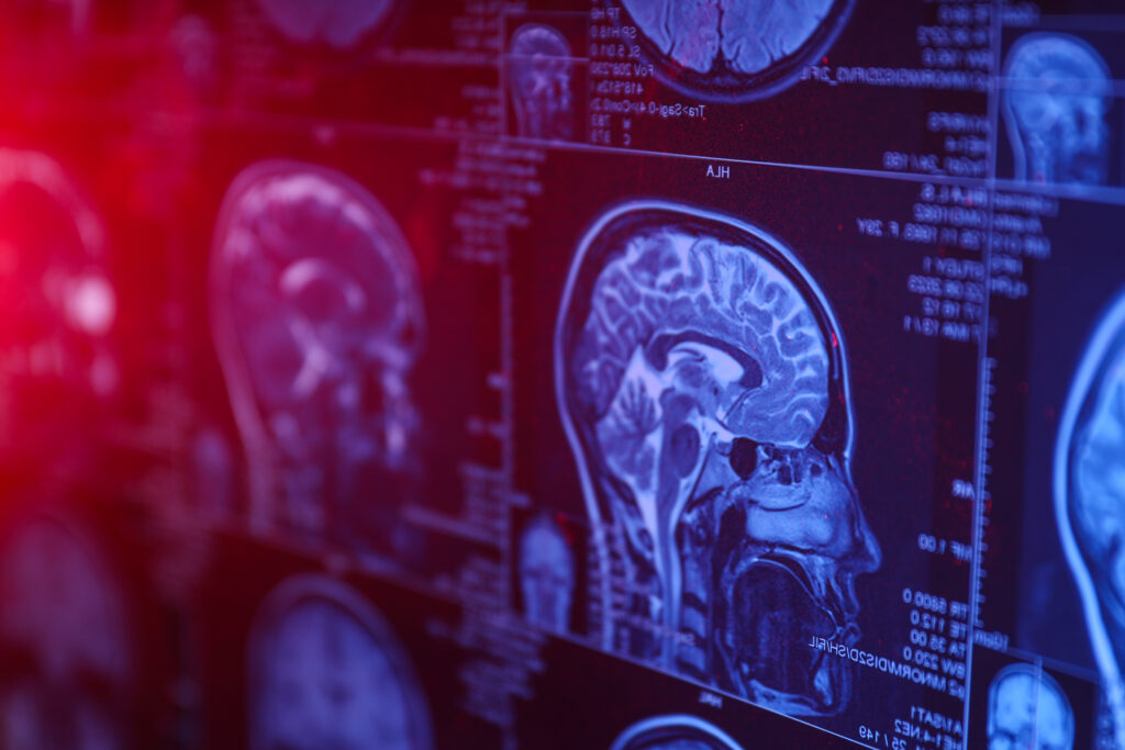 Ontario Brain Institute
