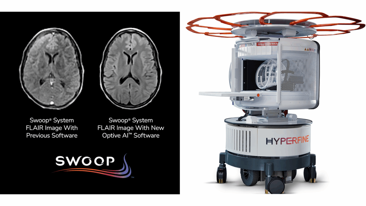 Optive AI, swoop, portable mri, portable mri machine, hyperfine, swoop portable mri system, swoop portable mri imaging system, swoop system, Neuroimaging, MRI, magnetic resonance imaging, Brain Scan