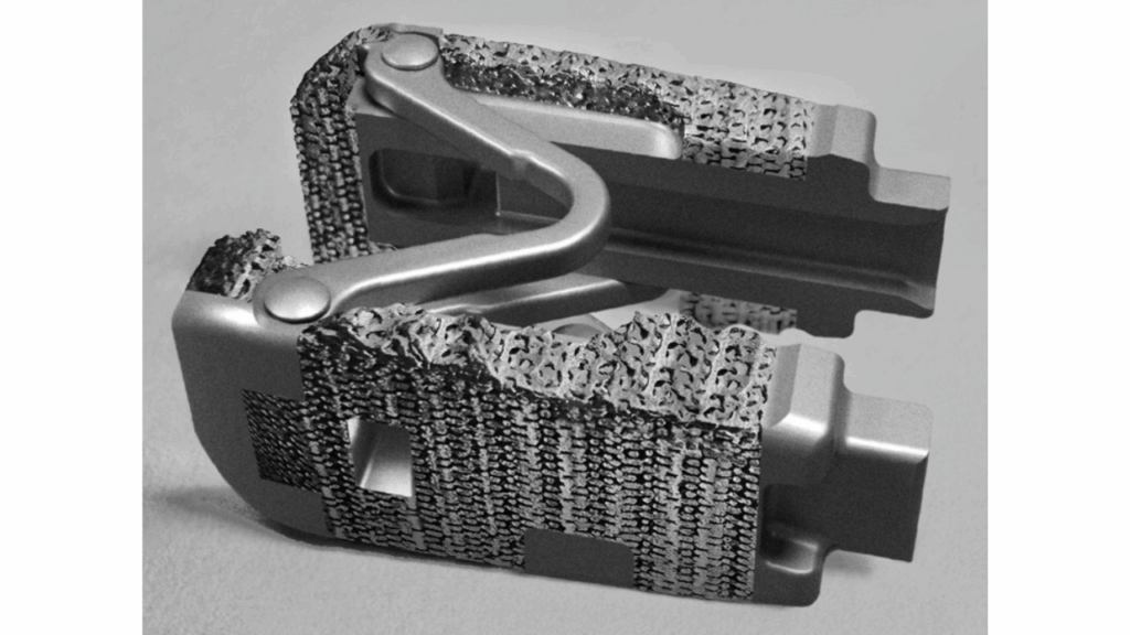 Spine Innovation LOGIC Titanium interbody system, interbody system, spinal fusion implant