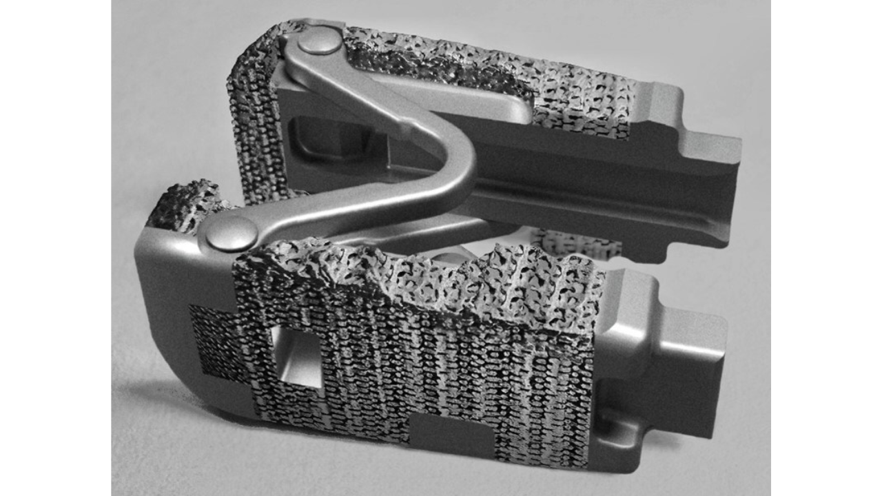 Spine Innovation LOGIC Titanium interbody system, interbody system, spinal fusion implant