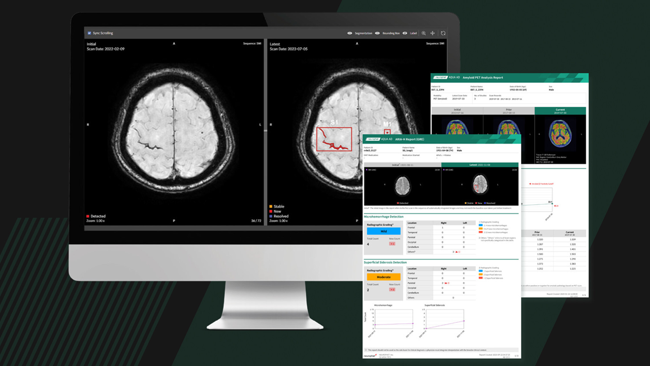 Neurophet AQUA AD Plus, Neurophet, AI based medical imaging