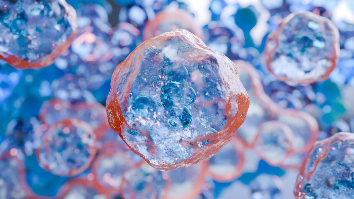 Off the shelf cell therapies bone marrow transplantation