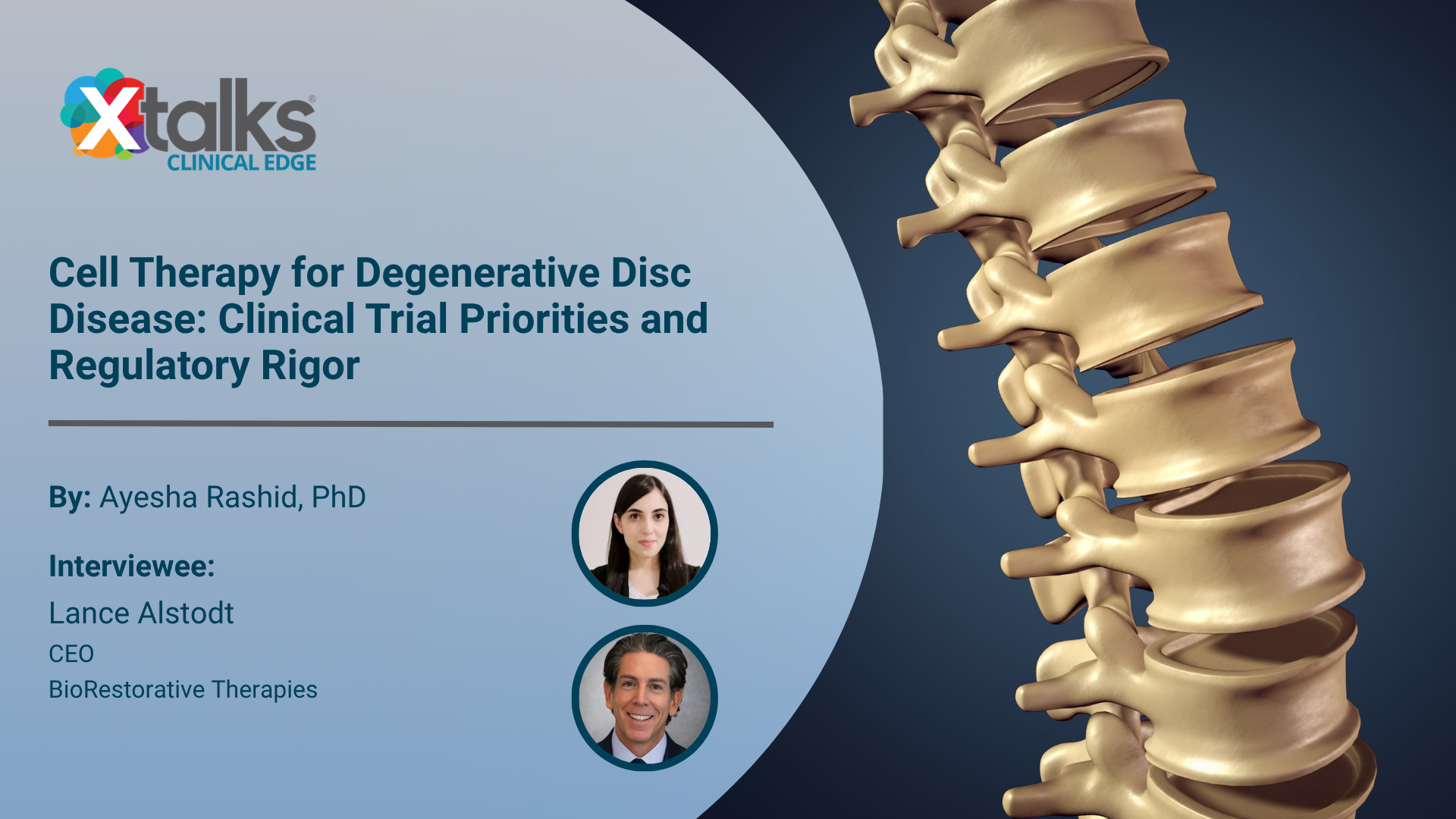 degenerative disc disease