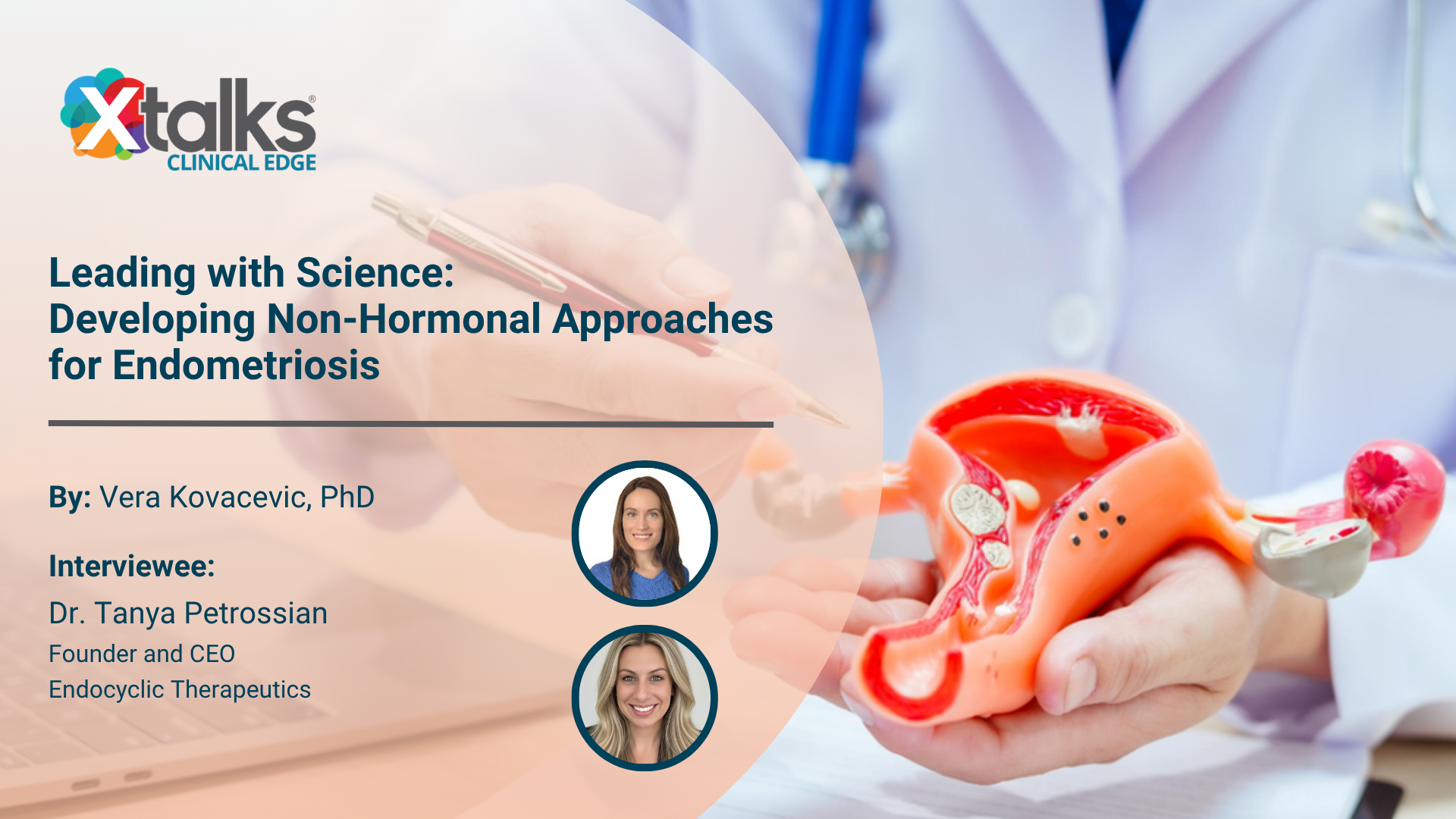non-hormonal endometriosis