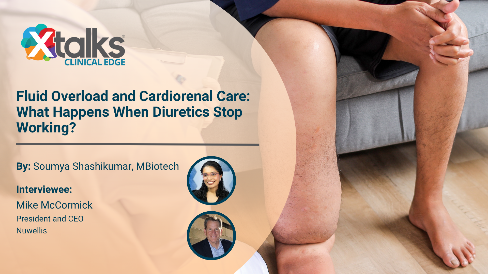 Fluid Overload and Cardiorenal Care: What Happens When Diuretics Stop Working?