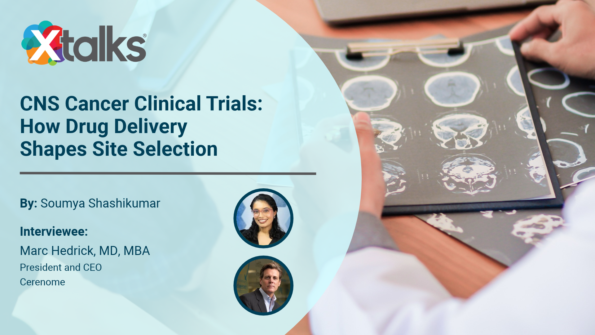 CNS Cancer Clinical Trials: How Drug Delivery Shapes Site Selection